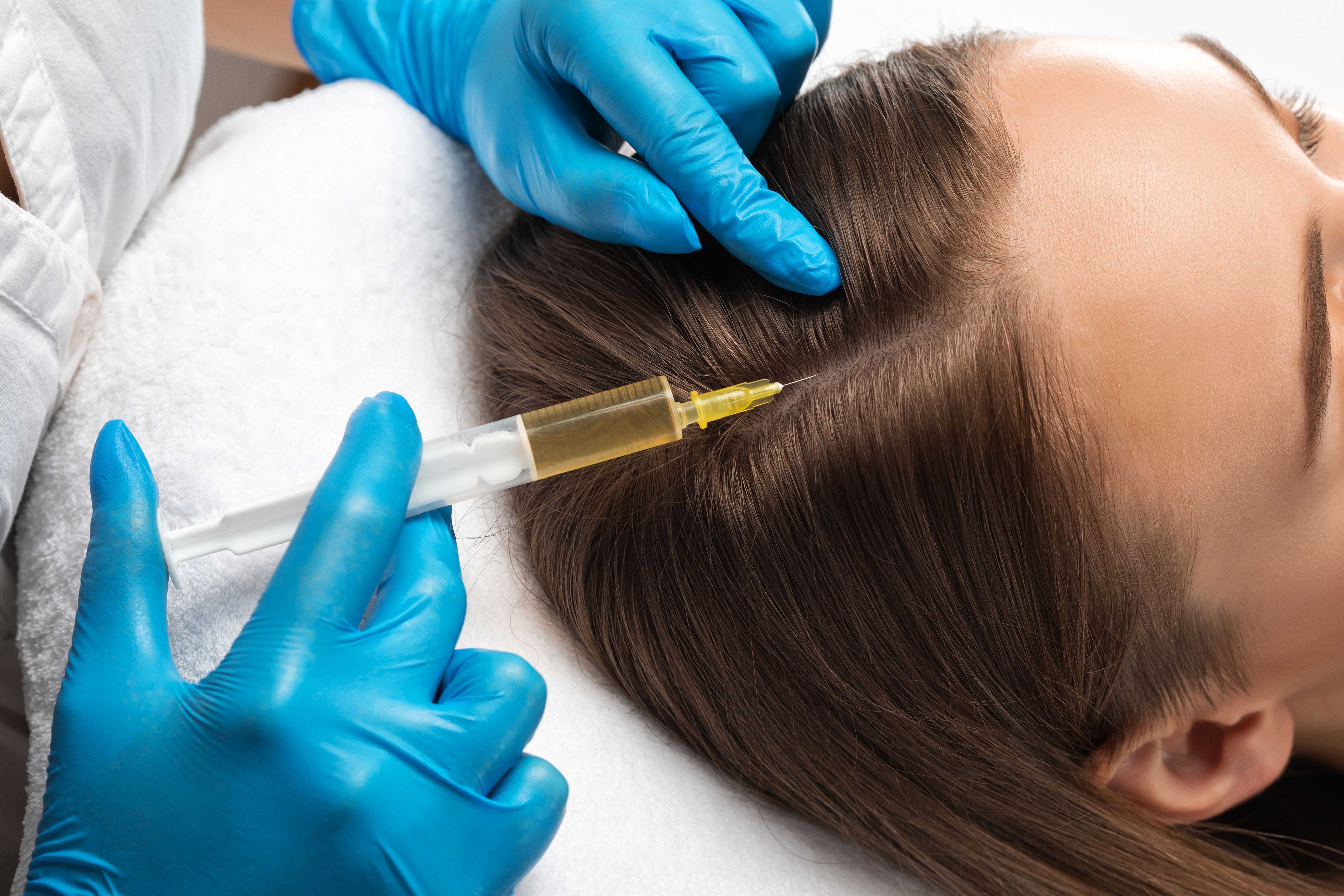 PRP Hair Restoration At Aesthetic Beauty By Lorraine