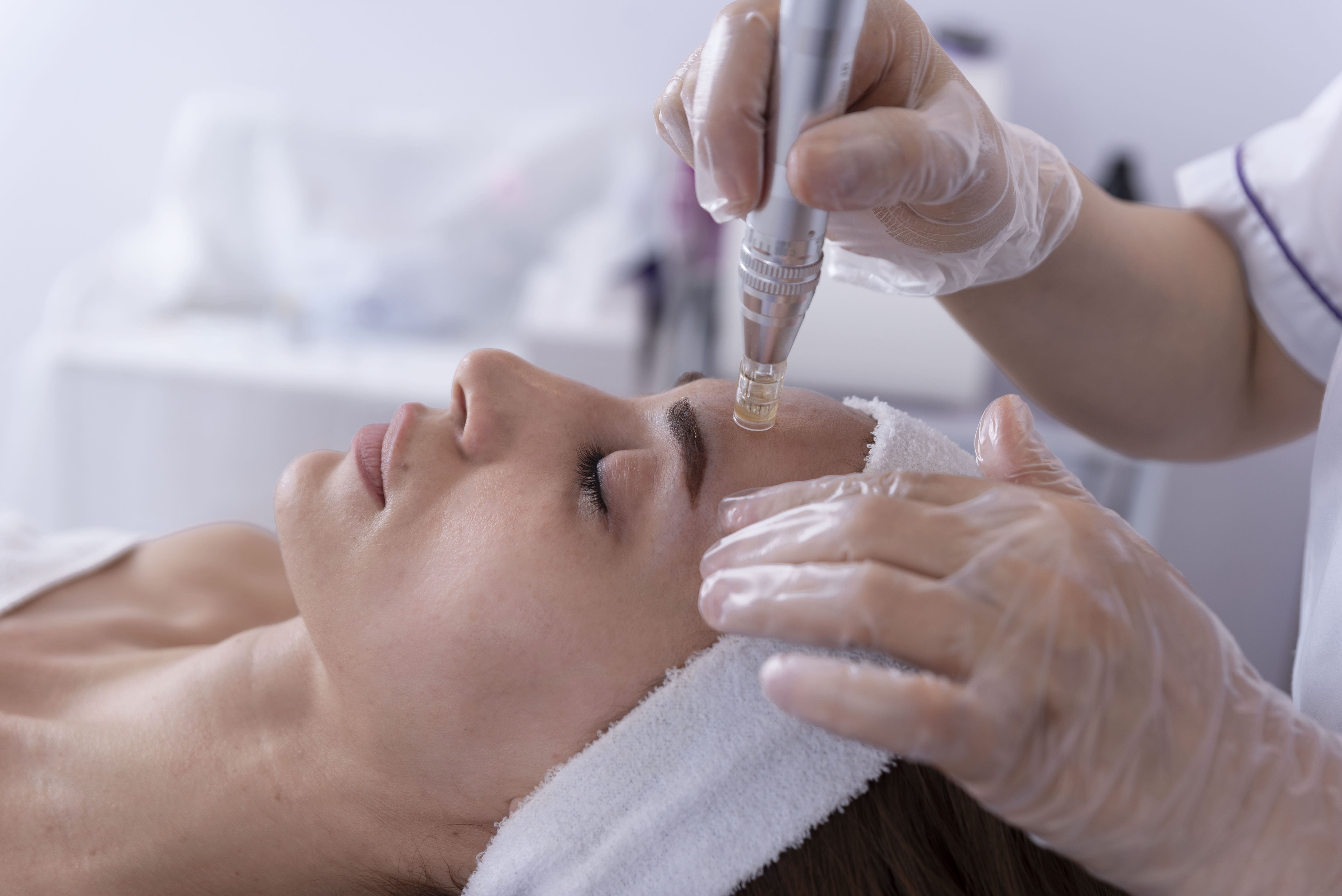 Hormonal Acne Treatment At Aesthetic Beauty By Lorraine
